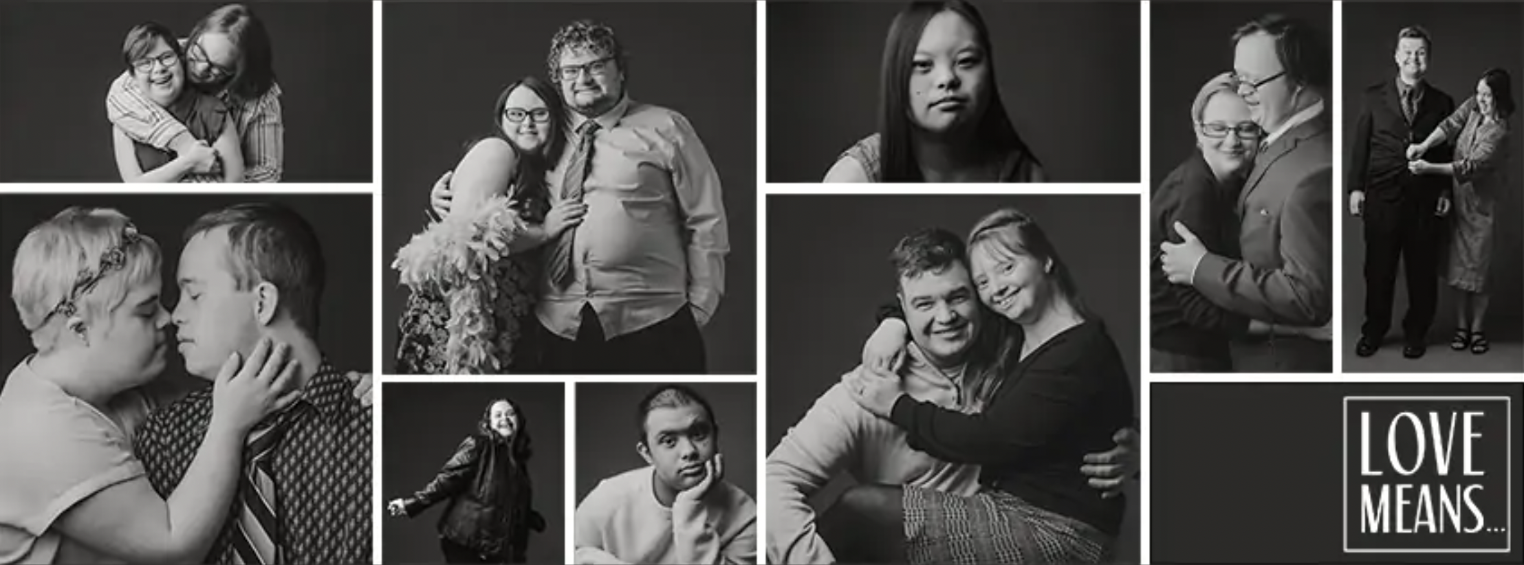 Couples With Down Syndrome in People Magazine